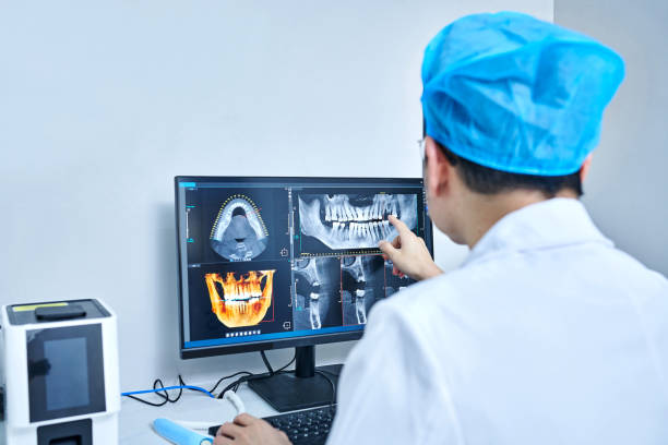 Best Emergency Wisdom Tooth Extraction in Bell Acres, PA